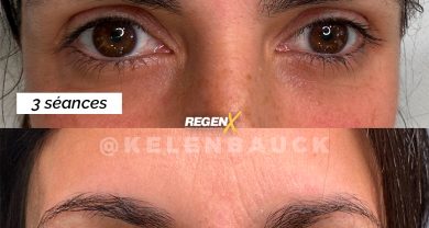 Protocole Regen-X