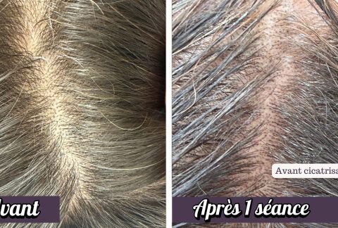 Trichopigmentation